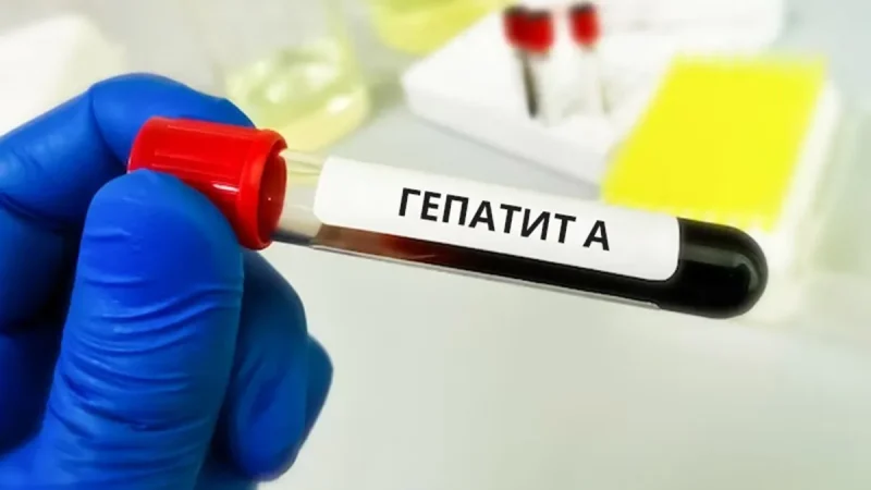 МОЗ розслідує джерело масового зараження гепатитом А в Києві